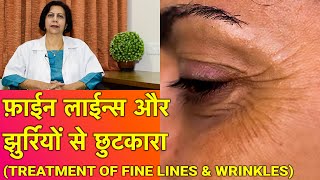 झुर्रियों से बचाव और ईलाज  Treatment of Wrinkles amp Fine Lines In HINDI [upl. by Cindra]