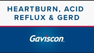 Heartburn Acid Reflux and GERD  Gaviscon® [upl. by Adil]