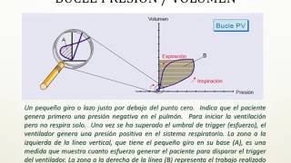 BUCLES O LAZOS EN VENTILACION MECANICA CON AUDIO [upl. by Eedrahs435]