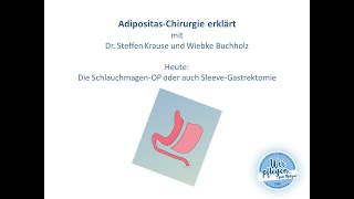 Adipositas Chirurgie erklärt Die SchlauchmagenOP oder auch SleeveGastrektomie [upl. by Llig]