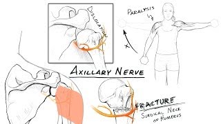 The Brachial Plexus II Animated Review HD [upl. by Attenod991]