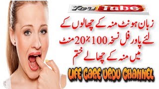 Mouth Blisters Treatment In Urdu   Blister In Mouth Treatment  Muh Ke Chalo Ka Ilaj [upl. by Nuahsyd]