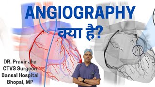 What is Angiography  Angiography kab karwayen  Dr Pravir Jha [upl. by Mozza]