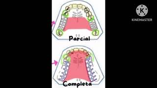 Video sobre prótesis parcial removible PPR de la Unidad 7 [upl. by Oilerua]