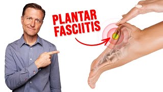 Fix Plantar Fasciitis Instantly NO MORE HEEL PAIN [upl. by Ahsitan]