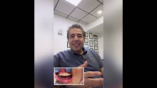 Wassim Bouzid orthodontist recontouring gingiva with a Spectrum Laser [upl. by Zebadiah954]