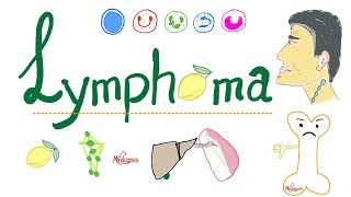 Lymphoma Introduction  Painless Enlarged Lymph Node  Hematology and Oncology Series [upl. by Annabelle]