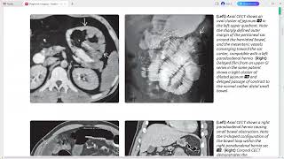 Peritoneum mesentery and abdominal wall imaging [upl. by Orabel399]