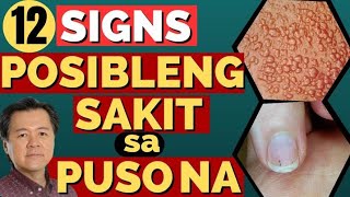 12 Signs na Posibleng Sakit sa Puso Na  By Doc Willie Ong Internist and Cardiologist [upl. by Neeka]