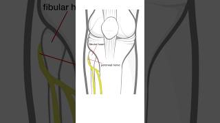 Foot Drop  L5 radiculopathy vs peroneal nerve injury [upl. by Alorac392]