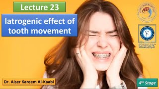 Iatrogenic effect of tooth movement lec23 تقويم الأسنان للمرحلة الرابعة [upl. by Rosy]