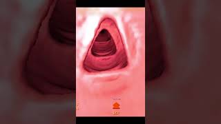 Gut Check  Gastrointestinal Endoscopy amp Cancer Detection 2024 [upl. by Hort557]