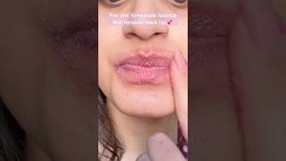 Dark lips solution 🤌🏻 lipcare pigmentedlips pinklips skincare skincareroutine homeremedies [upl. by Domash]