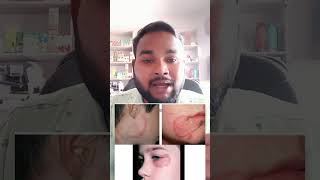 Fungal infection Cream l cream luliford l luliconazole cream l viral l youtubeshorts l by govind [upl. by Hussar]