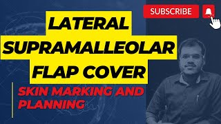 LATERAL SUPRAMALLEOLAR FLAP SKIN MARKING [upl. by Soisanahta]