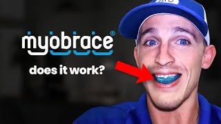 Watch this before you Buy Myobrace…Orthodontist Reviews [upl. by Rap48]