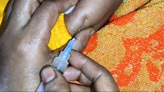 Intramuscular arms injectionIm cefepime Xemimax 500mginjection video 24 P33 by cannula 69 [upl. by Kenzie]