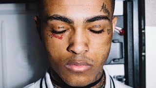 XXXTENTACION EST MORT ARRÊTEZ TOUTES VOS CONNERIES [upl. by Ardnuasak353]