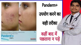 panderm cream review  panderm plus lagane se kya hota hai  penderm [upl. by Walli296]