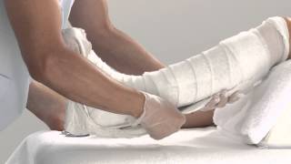 Plaster of Paris Lower Leg Splint Application [upl. by Anha670]