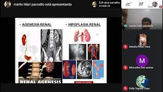 Nefrología  MALFORMACIÓN CONGENITA DEL RIÑON [upl. by Peppie]