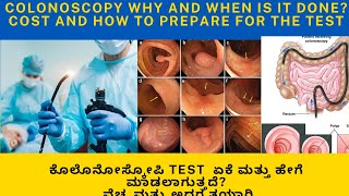 COLONOSCOPY WHY IS IT DONECOMPLICATIONSCOSTPREPARATION OF COLON AND REPORT EXPLAINED IN KANNADA [upl. by Shaya408]