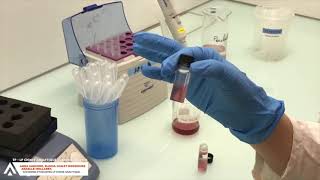 CHIMIE  TP génie analytique  Centrifugation [upl. by Sila113]