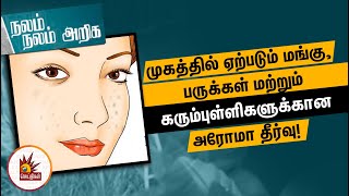 முகத்தில் ஏற்படும் மங்கு பருக்கள் மற்றும் கரும்புள்ளிகளுக்கான அரோமா தீர்வு  Nalam Nalam Ariga [upl. by Abbye]