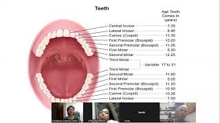 Teeth part 1 by Prof Sangeeta Burman अब अपने दांतो का उपचार करें एक्यूप्रेशर पद्धति द्वारा [upl. by Adnilg75]