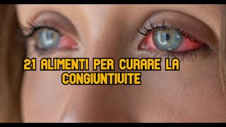 21 Alimenti per curare la congiuntivite [upl. by Leahcimrej]