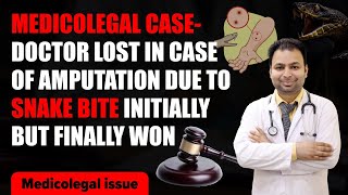 medicolegal case y doctor lost in case of amputation due to snake bite initially but finally won [upl. by Zweig]