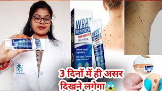 Wart Remover Ointment honest review 2023Wart Remover Ointment benefit usesampsideeffects review hindi [upl. by Uriel738]