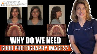 Why do we need good Dental Photography Images [upl. by Enialahs]