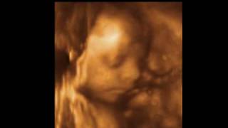 Baby Kinsley 28 weeks 3D 4D Ultrasound Scans  Charlotte 3D4D Ultrasound [upl. by Meurer]