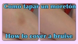 Como cubrir un moretón ♡ How to cover a bruise [upl. by Hambley452]