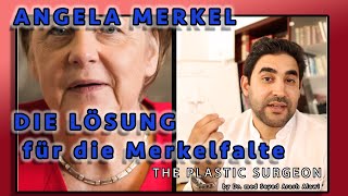 Angela Merkel Merkelfalte MundwinkelLifting  Grin lift  Botox  Hyluronsäure  Dr Alawi [upl. by Myrta]