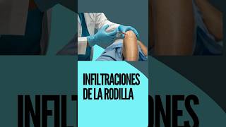 INFILTRACIONES DE LA RODILLA [upl. by Atnauqal]