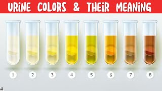 TAKE NOTE of this Urine Colors amp their Indications 🚨 [upl. by Ardnalahs]