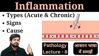 Inflammation Kya Hota Hai  Types  Acute and Chronic  Cause  Signs  Pathology Lecture in Hindi [upl. by Jessalyn]