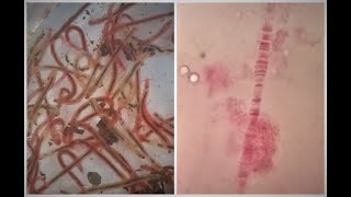 Salivary gland chromosomes Experiment  Polytene Chromosomes  Giant chromosomes [upl. by Aggy]