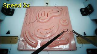 suturing laparoscopy surgeon knot [upl. by Krisha]