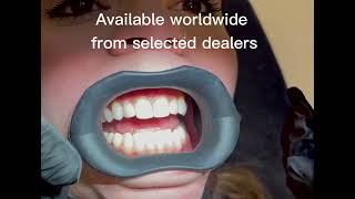 VisionButler Soft comfortable reusable autoclavable Lip and cheek retractor [upl. by Nnylyt]