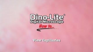 How to View Capillaries using DinoLite USB Microscopes [upl. by Ribaj]