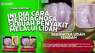 SEMINAR KESEHATAN  DIAGNOSA LIDAH PETA ORGAN DAN PERMASALAHAN JIWA [upl. by Sebastiano759]