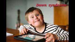 Down syndrome mrcpch Clinical General Examination [upl. by Trebma]