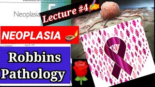 neoplasiapathology Lecture4 neoplasia pathology robbins neoplasia pathology lecture pathology [upl. by Heer]