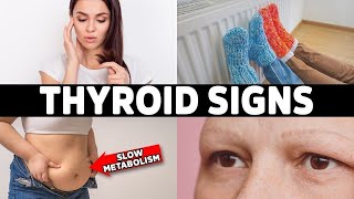 HYPOTHYROIDISM Don’t Ignore These 7 Early Warning Signs [upl. by Nallac]