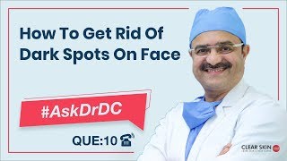 Get Rid Of Dark Spots On Faceचेहरे के काले धब्बों से छुटकारा पाएं AskDrDc Ep 10  In HINDI [upl. by Muhan]