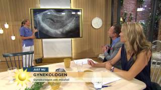 Gynekologen quotInga ökade risker för missfall vid tidigt ultraljudquot  Nyhetsmorgon TV4 [upl. by Immak]