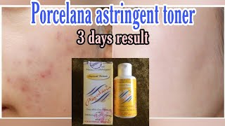 PORCELANA astringent tonerFast review3 to 5 days result sulit and effective [upl. by Hayyifas]